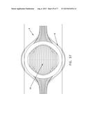 METHOD AND APPARATUS FOR RESTRICTING FLOW THROUGH AN OPENING IN THE SIDE     WALL OF A BODY LUMEN, AND/OR FOR REINFORCING A WEAKNESS IN THE SIDE WALL     OF A BODY LUMEN, WHILE STILL MAINTAINING SUBSTANTIALLY NORMAL FLOW     THROUGH THE BODY LUMEN diagram and image