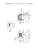 METHOD AND APPARATUS FOR RESTRICTING FLOW THROUGH AN OPENING IN THE SIDE     WALL OF A BODY LUMEN, AND/OR FOR REINFORCING A WEAKNESS IN THE SIDE WALL     OF A BODY LUMEN, WHILE STILL MAINTAINING SUBSTANTIALLY NORMAL FLOW     THROUGH THE BODY LUMEN diagram and image