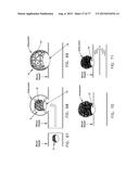 METHOD AND APPARATUS FOR RESTRICTING FLOW THROUGH AN OPENING IN THE SIDE     WALL OF A BODY LUMEN, AND/OR FOR REINFORCING A WEAKNESS IN THE SIDE WALL     OF A BODY LUMEN, WHILE STILL MAINTAINING SUBSTANTIALLY NORMAL FLOW     THROUGH THE BODY LUMEN diagram and image