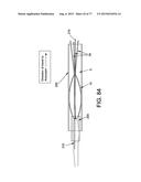 METHOD AND APPARATUS FOR RESTRICTING FLOW THROUGH AN OPENING IN THE SIDE     WALL OF A BODY LUMEN, AND/OR FOR REINFORCING A WEAKNESS IN THE SIDE WALL     OF A BODY LUMEN, WHILE STILL MAINTAINING SUBSTANTIALLY NORMAL FLOW     THROUGH THE BODY LUMEN diagram and image