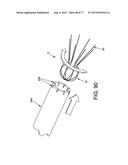 METHOD AND APPARATUS FOR RESTRICTING FLOW THROUGH AN OPENING IN THE SIDE     WALL OF A BODY LUMEN, AND/OR FOR REINFORCING A WEAKNESS IN THE SIDE WALL     OF A BODY LUMEN, WHILE STILL MAINTAINING SUBSTANTIALLY NORMAL FLOW     THROUGH THE BODY LUMEN diagram and image