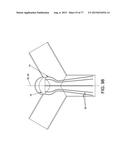 METHOD AND APPARATUS FOR RESTRICTING FLOW THROUGH AN OPENING IN THE SIDE     WALL OF A BODY LUMEN, AND/OR FOR REINFORCING A WEAKNESS IN THE SIDE WALL     OF A BODY LUMEN, WHILE STILL MAINTAINING SUBSTANTIALLY NORMAL FLOW     THROUGH THE BODY LUMEN diagram and image