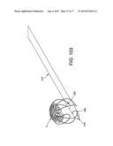 METHOD AND APPARATUS FOR RESTRICTING FLOW THROUGH AN OPENING IN THE SIDE     WALL OF A BODY LUMEN, AND/OR FOR REINFORCING A WEAKNESS IN THE SIDE WALL     OF A BODY LUMEN, WHILE STILL MAINTAINING SUBSTANTIALLY NORMAL FLOW     THROUGH THE BODY LUMEN diagram and image