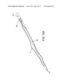 METHOD AND APPARATUS FOR RESTRICTING FLOW THROUGH AN OPENING IN THE SIDE     WALL OF A BODY LUMEN, AND/OR FOR REINFORCING A WEAKNESS IN THE SIDE WALL     OF A BODY LUMEN, WHILE STILL MAINTAINING SUBSTANTIALLY NORMAL FLOW     THROUGH THE BODY LUMEN diagram and image