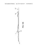 METHOD AND APPARATUS FOR RESTRICTING FLOW THROUGH AN OPENING IN THE SIDE     WALL OF A BODY LUMEN, AND/OR FOR REINFORCING A WEAKNESS IN THE SIDE WALL     OF A BODY LUMEN, WHILE STILL MAINTAINING SUBSTANTIALLY NORMAL FLOW     THROUGH THE BODY LUMEN diagram and image