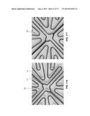 METHOD AND APPARATUS FOR RESTRICTING FLOW THROUGH AN OPENING IN THE SIDE     WALL OF A BODY LUMEN, AND/OR FOR REINFORCING A WEAKNESS IN THE SIDE WALL     OF A BODY LUMEN, WHILE STILL MAINTAINING SUBSTANTIALLY NORMAL FLOW     THROUGH THE BODY LUMEN diagram and image