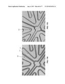 METHOD AND APPARATUS FOR RESTRICTING FLOW THROUGH AN OPENING IN THE SIDE     WALL OF A BODY LUMEN, AND/OR FOR REINFORCING A WEAKNESS IN THE SIDE WALL     OF A BODY LUMEN, WHILE STILL MAINTAINING SUBSTANTIALLY NORMAL FLOW     THROUGH THE BODY LUMEN diagram and image