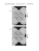 METHOD AND APPARATUS FOR RESTRICTING FLOW THROUGH AN OPENING IN THE SIDE     WALL OF A BODY LUMEN, AND/OR FOR REINFORCING A WEAKNESS IN THE SIDE WALL     OF A BODY LUMEN, WHILE STILL MAINTAINING SUBSTANTIALLY NORMAL FLOW     THROUGH THE BODY LUMEN diagram and image