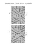 METHOD AND APPARATUS FOR RESTRICTING FLOW THROUGH AN OPENING IN THE SIDE     WALL OF A BODY LUMEN, AND/OR FOR REINFORCING A WEAKNESS IN THE SIDE WALL     OF A BODY LUMEN, WHILE STILL MAINTAINING SUBSTANTIALLY NORMAL FLOW     THROUGH THE BODY LUMEN diagram and image