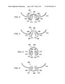 NASAL GUIDE AND METHOD OF USE THEREOF diagram and image