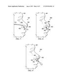 NASAL GUIDE AND METHOD OF USE THEREOF diagram and image