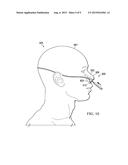 NASAL GUIDE AND METHOD OF USE THEREOF diagram and image