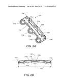 BONE FASTENER FOR A SPINAL FIXATION ASSEMBLY diagram and image