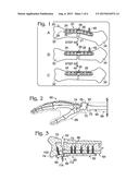 ADJUSTABLE BONE PLATES diagram and image