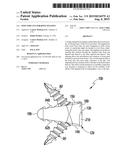 Foot Implant For Bone Fixation diagram and image