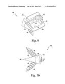 Foot Implant For Bone Fixation diagram and image