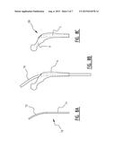 Drill Alignment Device, Method for Manufacturing the Drill Alignment     Device and a Method for Removing Bone Cement diagram and image