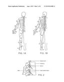 Systems and Methods for Neuromodulation for Treatment of Pain and Other     Disorders Associated with Nerve Conduction diagram and image