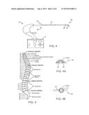 Systems and Methods for Neuromodulation for Treatment of Pain and Other     Disorders Associated with Nerve Conduction diagram and image