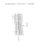 Systems and Methods for Neuromodulation for Treatment of Pain and Other     Disorders Associated with Nerve Conduction diagram and image