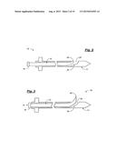 TRANSPEDICULAR ACCESS TO THE INTERVERTEBRAL DISC SPACE FOR DISCECTOMY, END     PLATE PREPARATION, AND INTERBODY FUSION diagram and image