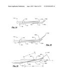 TRANSPEDICULAR ACCESS TO THE INTERVERTEBRAL DISC SPACE FOR DISCECTOMY, END     PLATE PREPARATION, AND INTERBODY FUSION diagram and image