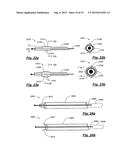 TRANSPEDICULAR ACCESS TO THE INTERVERTEBRAL DISC SPACE FOR DISCECTOMY, END     PLATE PREPARATION, AND INTERBODY FUSION diagram and image