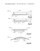 TRANSPEDICULAR ACCESS TO THE INTERVERTEBRAL DISC SPACE FOR DISCECTOMY, END     PLATE PREPARATION, AND INTERBODY FUSION diagram and image