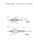 TRANSPEDICULAR ACCESS TO THE INTERVERTEBRAL DISC SPACE FOR DISCECTOMY, END     PLATE PREPARATION, AND INTERBODY FUSION diagram and image