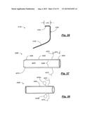 TRANSPEDICULAR ACCESS TO THE INTERVERTEBRAL DISC SPACE FOR DISCECTOMY, END     PLATE PREPARATION, AND INTERBODY FUSION diagram and image