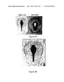 CONTROLLED PHOTOMECHANICAL AND PHOTOTHERMAL TISSUE TREATMENT IN THE     PICOSECOND REGIME diagram and image