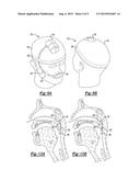 ENDOSCOPIC DEVICE AND SYSTEM diagram and image