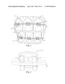 APPARATUS AND METHOD FOR ORTHODONTIC TREATMENT diagram and image