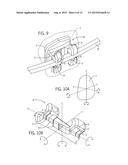 APPARATUS AND METHOD FOR ORTHODONTIC TREATMENT diagram and image