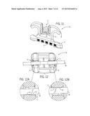 APPARATUS AND METHOD FOR ORTHODONTIC TREATMENT diagram and image