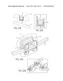 APPARATUS AND METHOD FOR ORTHODONTIC TREATMENT diagram and image