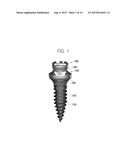 PALATAL IMPLANT FOR OVERDENTURE diagram and image