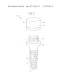 PALATAL IMPLANT FOR OVERDENTURE diagram and image