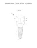 PALATAL IMPLANT FOR OVERDENTURE diagram and image