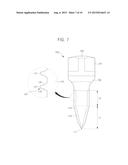 PALATAL IMPLANT FOR OVERDENTURE diagram and image