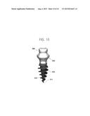 PALATAL IMPLANT FOR OVERDENTURE diagram and image