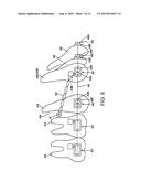 DENTAL COMPONENT, METAL POWDER FOR POWDER METALLURGY, AND METHOD FOR     PRODUCING DENTAL COMPONENT diagram and image