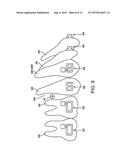 DENTAL COMPONENT, METAL POWDER FOR POWDER METALLURGY, AND METHOD FOR     PRODUCING DENTAL COMPONENT diagram and image