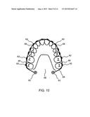 DENTAL COMPONENT, METAL POWDER FOR POWDER METALLURGY, AND METHOD FOR     PRODUCING DENTAL COMPONENT diagram and image