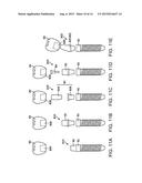 DENTAL COMPONENT, METAL POWDER FOR POWDER METALLURGY, AND METHOD FOR     PRODUCING DENTAL COMPONENT diagram and image