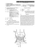 SYSTEMS FOR QUICKLY DELIVERING A PROSTHETIC HEART VALVE diagram and image