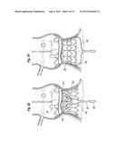 SYSTEMS FOR QUICKLY DELIVERING A PROSTHETIC HEART VALVE diagram and image