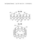 SYSTEMS FOR QUICKLY DELIVERING A PROSTHETIC HEART VALVE diagram and image