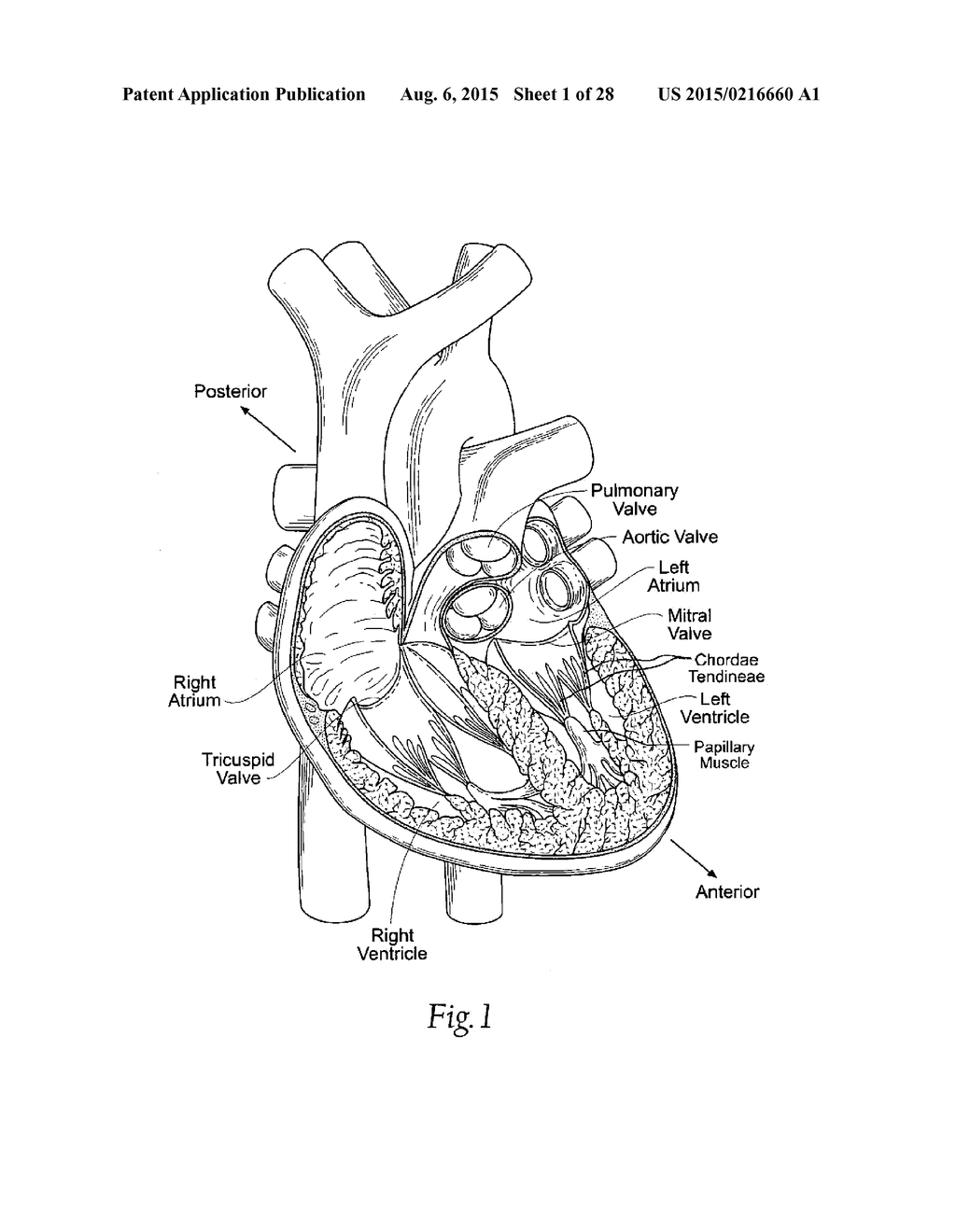 RAPID DEPLOYMENT METHODS FOR PROSTHETIC HEART VALVES - diagram, schematic, and image 02