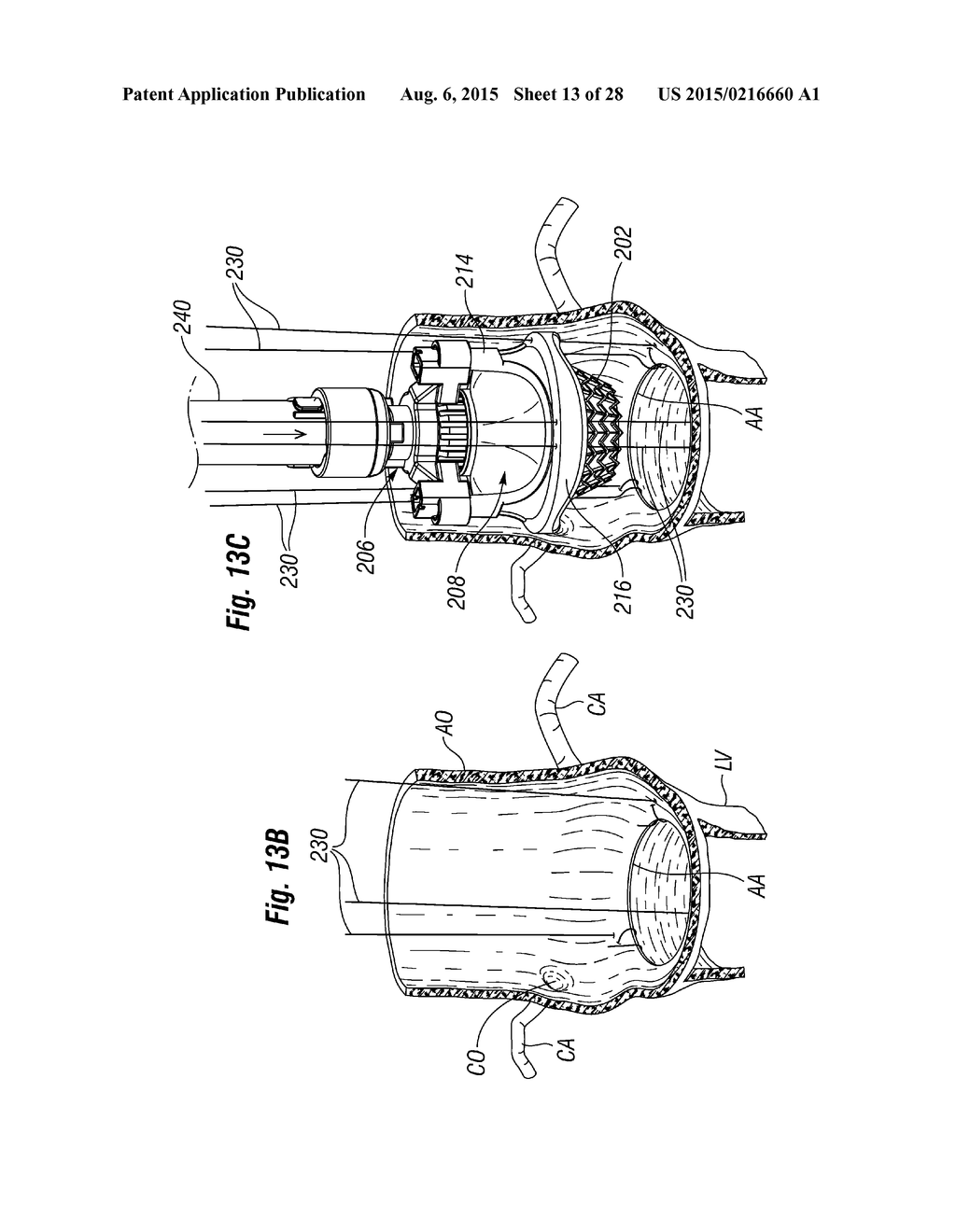 RAPID DEPLOYMENT METHODS FOR PROSTHETIC HEART VALVES - diagram, schematic, and image 14